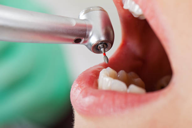 Best Urgent Tooth Repair  in Gardiner, ME